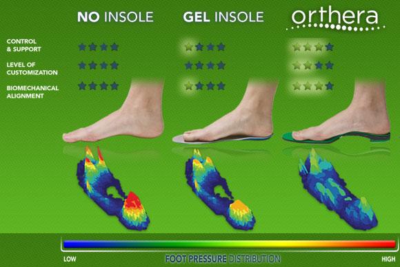 Foot Pain: Insoles vs. Orthotic Inserts