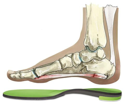 Heel/Plantar Pain